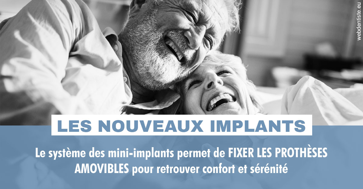 https://dr-robert-philippe.chirurgiens-dentistes.fr/Les nouveaux implants 2