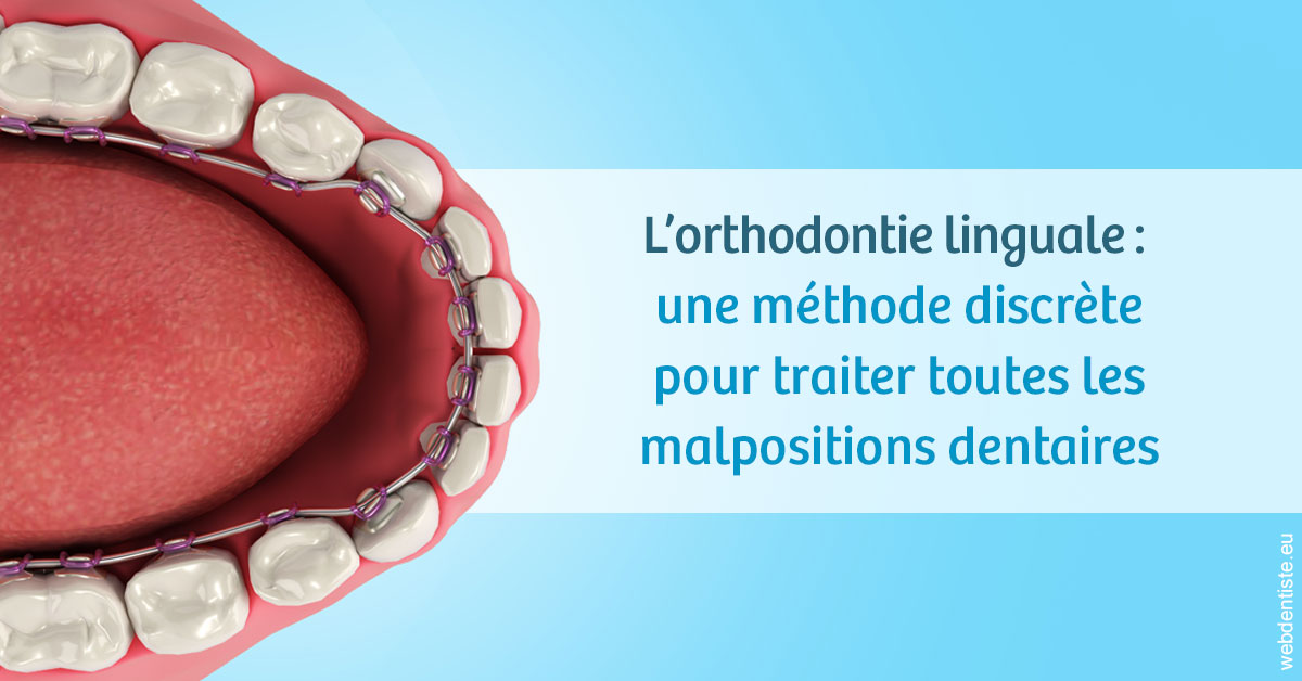 https://dr-robert-philippe.chirurgiens-dentistes.fr/L'orthodontie linguale 1