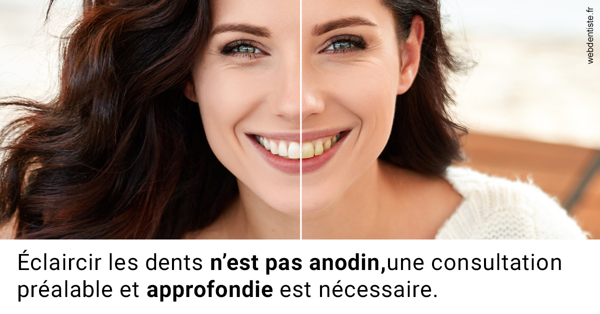 https://dr-robert-philippe.chirurgiens-dentistes.fr/Le blanchiment 2