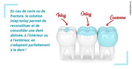 https://dr-robert-philippe.chirurgiens-dentistes.fr/L'INLAY ou l'ONLAY