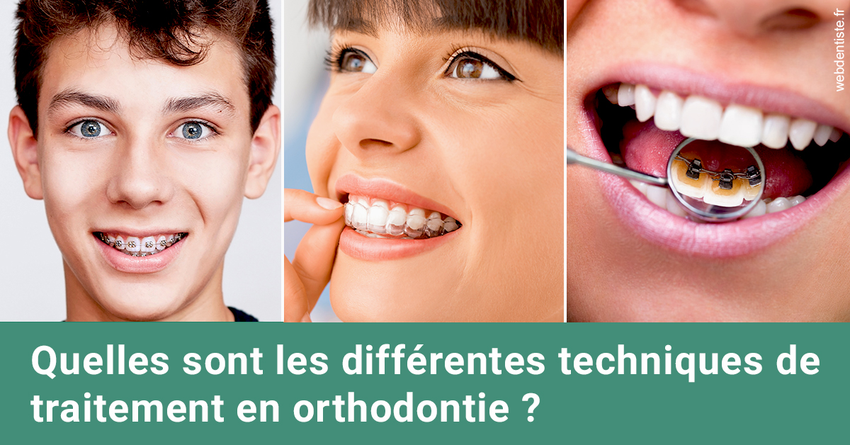 https://dr-robert-philippe.chirurgiens-dentistes.fr/Les différentes techniques de traitement 2