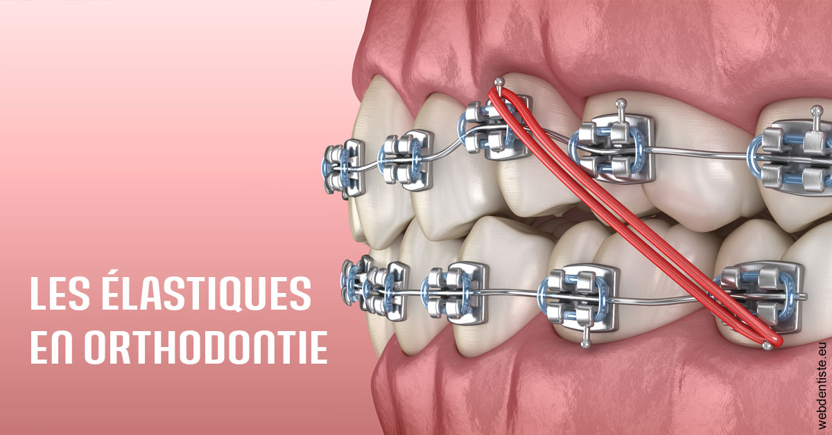 https://dr-robert-philippe.chirurgiens-dentistes.fr/Elastiques orthodontie 2