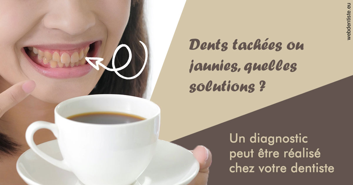 https://dr-robert-philippe.chirurgiens-dentistes.fr/Dents tachées 1