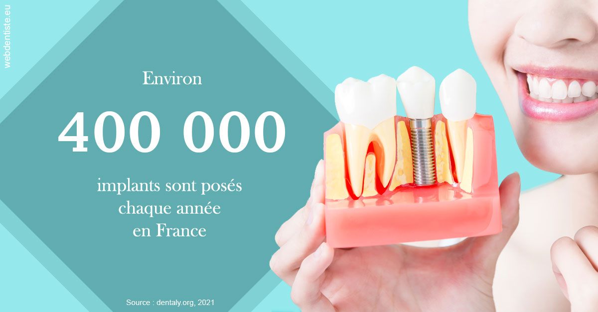 https://dr-robert-philippe.chirurgiens-dentistes.fr/Pose d'implants en France 2